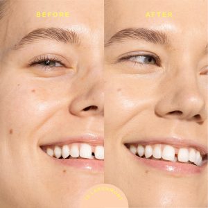 SunnyDays™ Tinted SPF 30